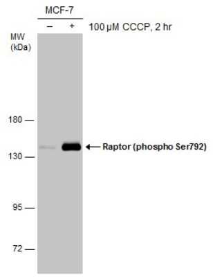 Western Blot: RPTOR [p Ser792] Antibody [NBP3-13173]